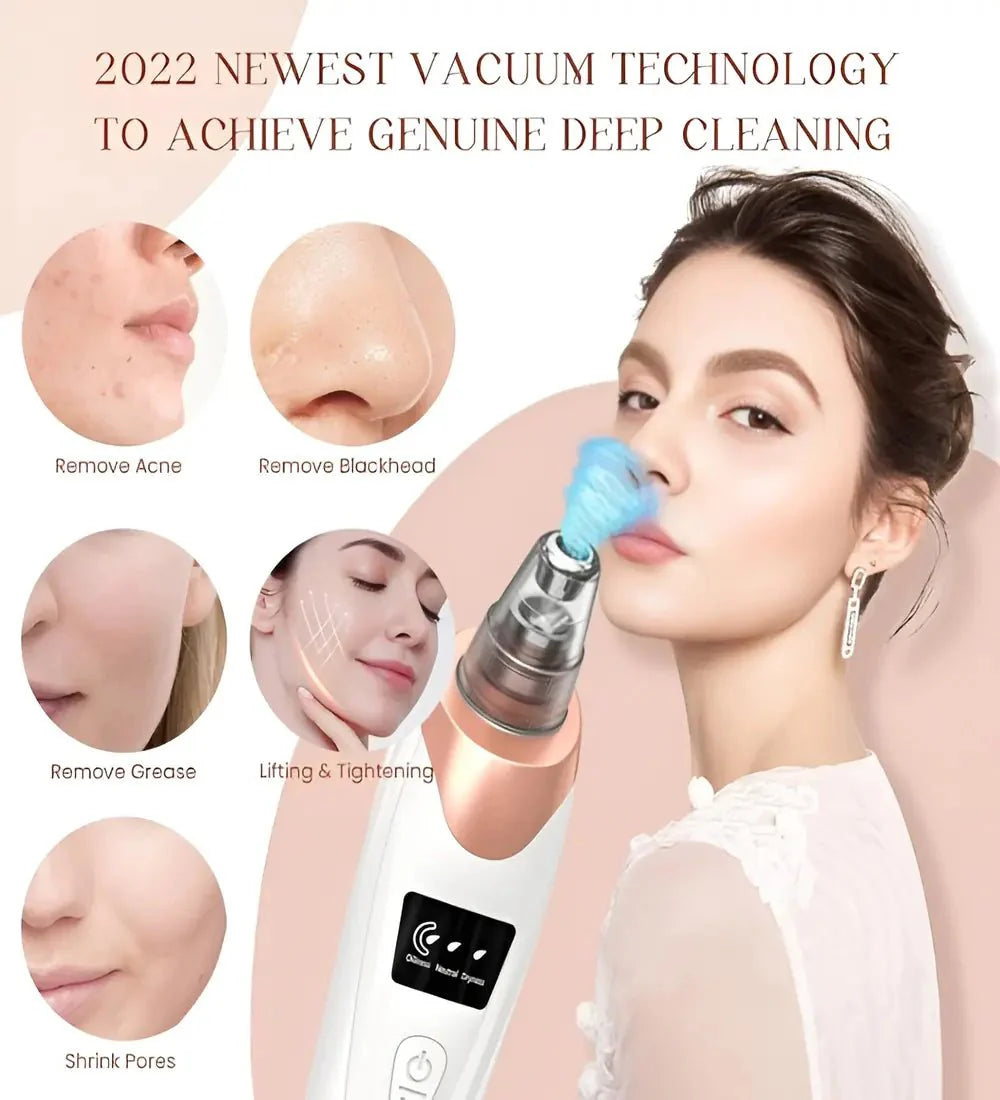 5 in 1 Blackhead Remover Vacuum Suction Device — Deep Pore Cleansing Acne Remover for All Skin Types